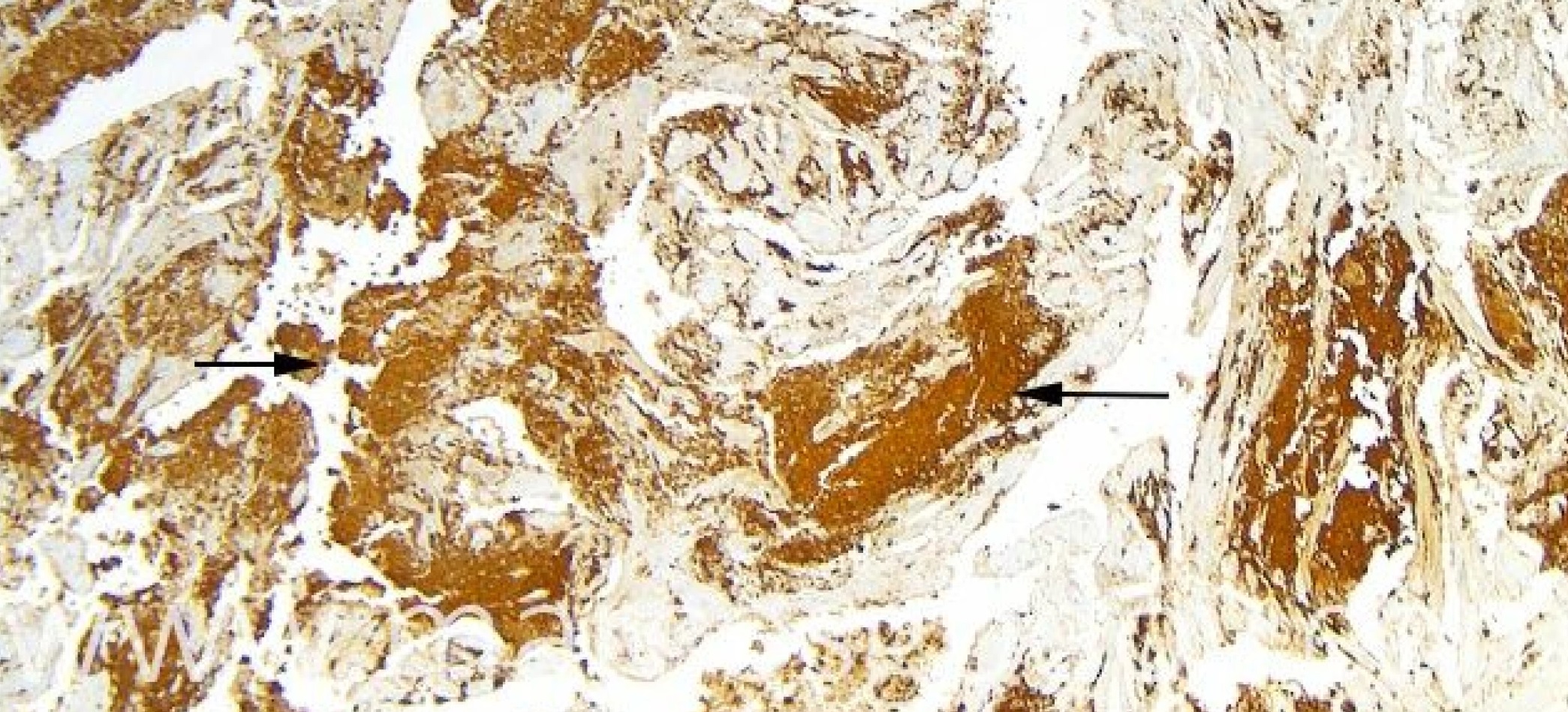 CIBA entrega datos sobre el rol de la bacteria del riñón en la mortalidad de salmónidos